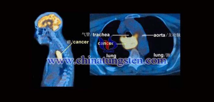 PET-CT tungsten alloy collimator picture